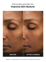 6% Mandelic Acid + 2% Lactic Acid Liquid Exfoliant